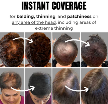 SOLU Hair Loss Concealer