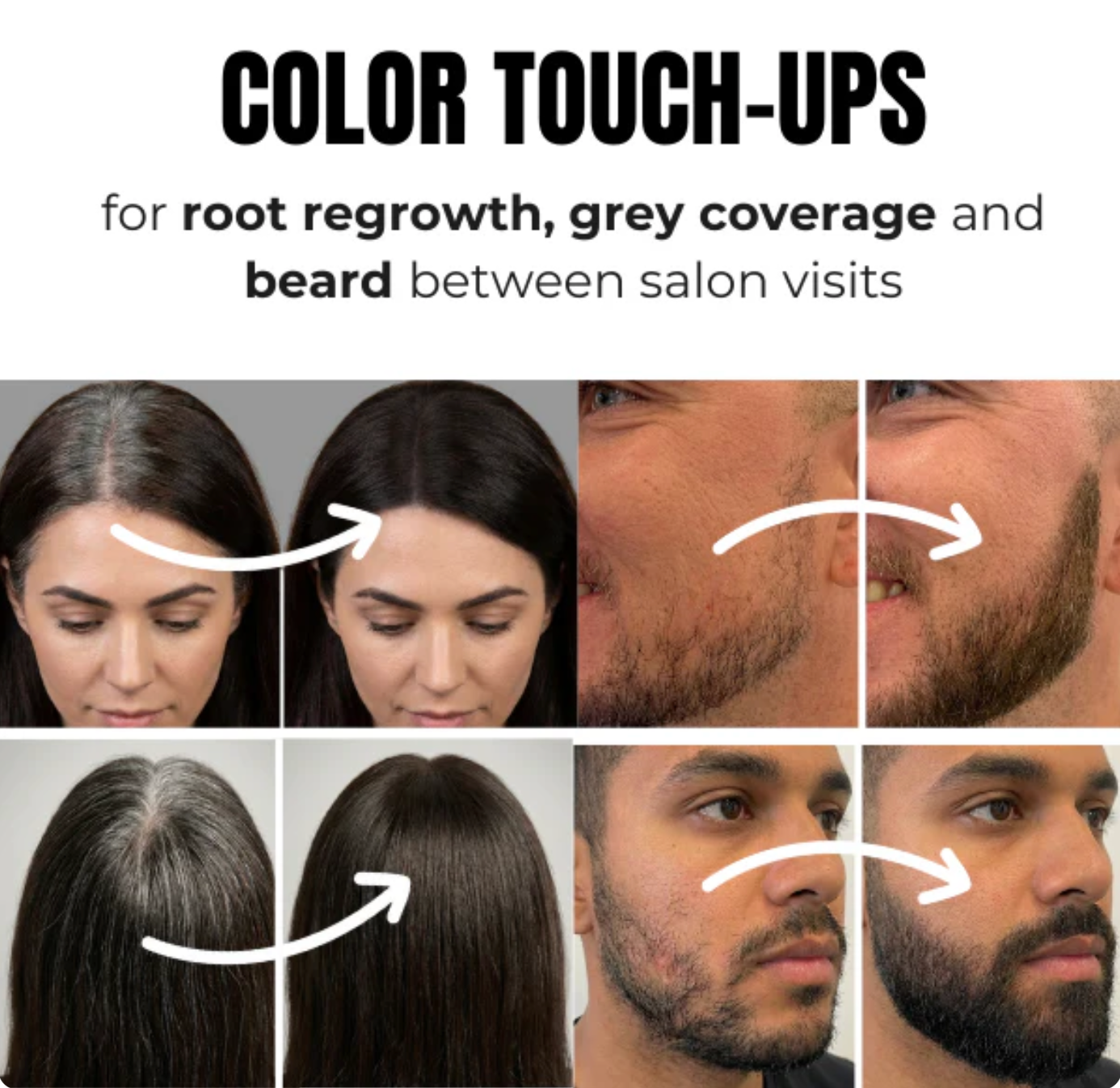 SOLU Hair Loss Concealer